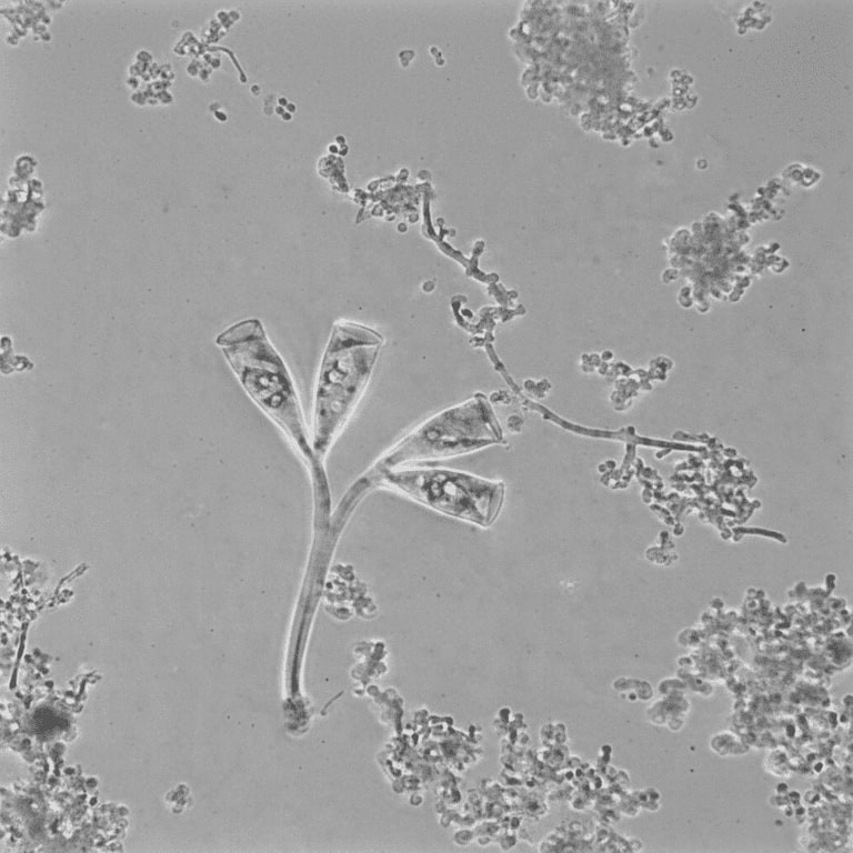 Mikroskopisches Bild von Belebtschlamm: in der Mitte: Glockentierchen